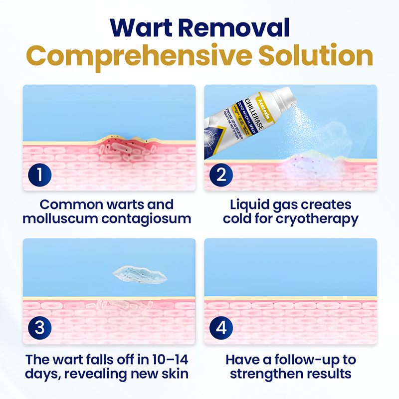 Acezozla® ChillErase Bump Renewal Spray