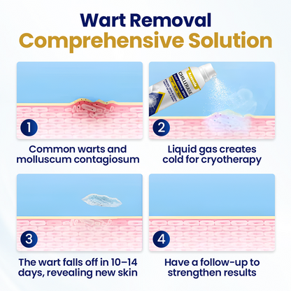 Acezozla® ChillErase Bump Renewal Spray