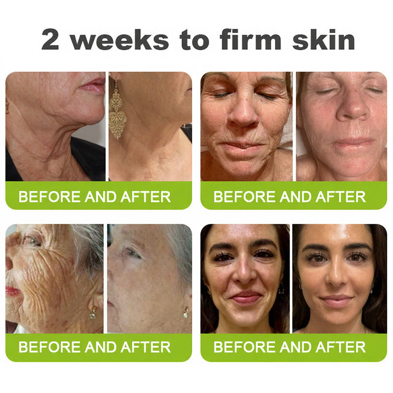🧠👨‍⚕️Made and shipped from the USA 💫ACEZOZLA® Skin Tightening & Vita-A Retinol Retinol shot Anti-Wrinkle Firming Tightening cream - Last Day Promotion 70% OFF