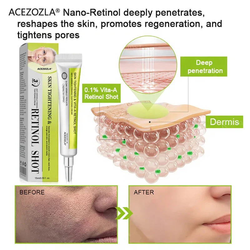 🧠👨‍⚕️Made and shipped from the USA 💫ACEZOZLA® Skin Tightening & Vita-A Retinol Retinol shot Anti-Wrinkle Firming Tightening cream - Last Day Promotion 70% OFF