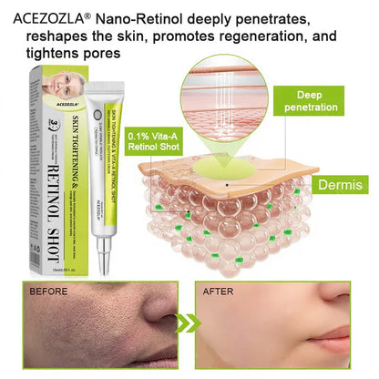🧠👨‍⚕️Made and shipped from the USA 💫ACEZOZLA® Skin Tightening & Vita-A Retinol Retinol shot Anti-Wrinkle Firming Tightening cream - Last Day Promotion 70% OFF