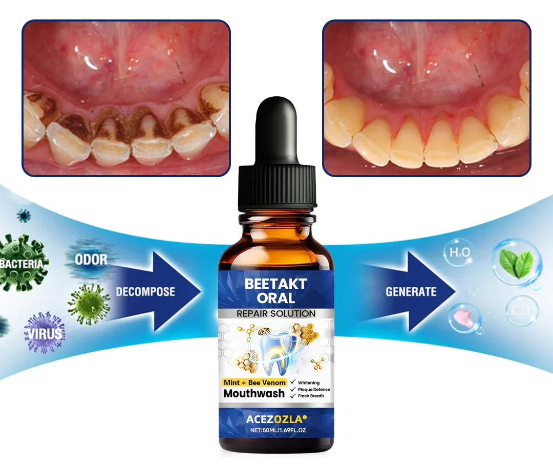 ACEZOZLA® BeeTakt Oral Repair Solution