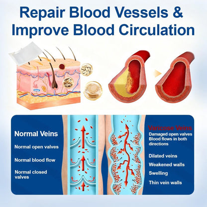 👨‍⚕️Hotplex®VeinFlow Microneedle Care Patch⚡Instant Relief, Long-Term Results