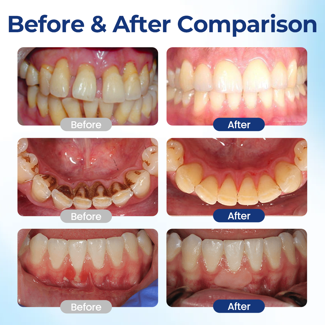 ACEZOZLA® BeeTakt Oral Repair Solution