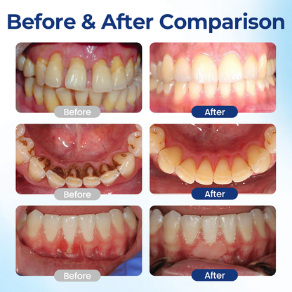 ACEZOZLA® BeeTakt Oral Repair Solution