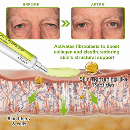 🧠👨‍⚕️Made and shipped from the USA 💫ACEZOZLA® Skin Tightening & Vita-A Retinol Retinol shot Anti-Wrinkle Firming Tightening cream - Last Day Promotion 70% OFF