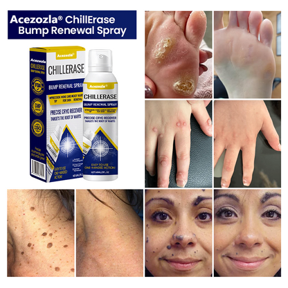 Acezozla® ChillErase Bump Renewal Spray